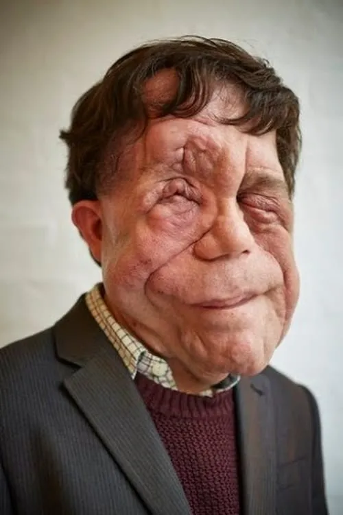 Adam Pearson en el reparto