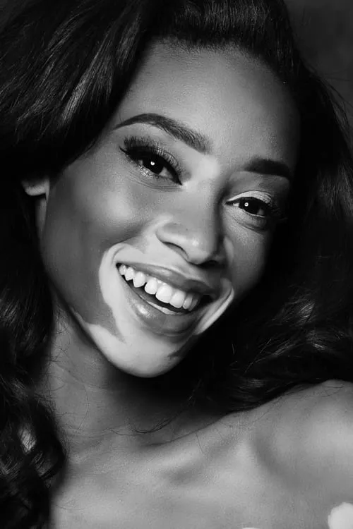 Winnie Harlow interpretando a Self