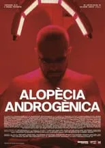 Andrés Mellinas interpreta a Self en Alopècia androgènica