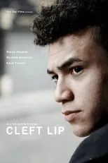 Reece Douglas es  en Cleft Lip