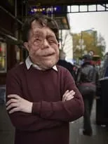 Adam Pearson interpreta a Self en The Ugly Face of Disability Hate Crime