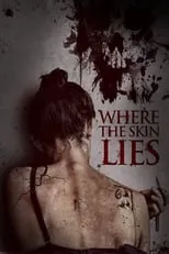 Tristan Beint interpreta a Edward Stirling en Where the Skin Lies